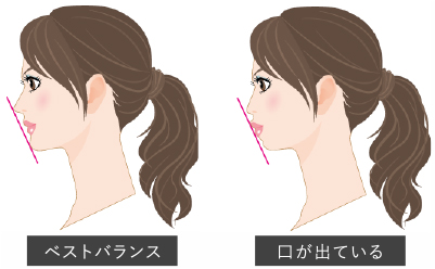 口元の印象の変化