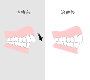 歯の問題に対する治療