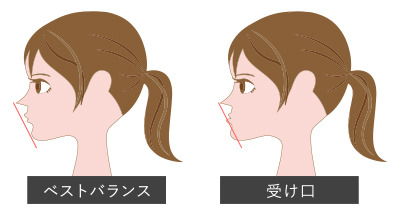 顔貌の印象の変化